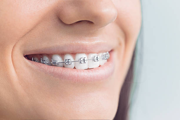 Best Tooth Extraction  in Kewanee, IL